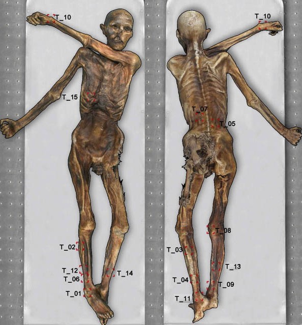 Click to view larger image illustration of tattoo placement.