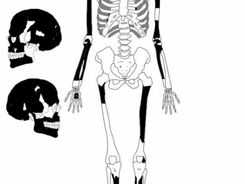 Graphic of skeleton and skull