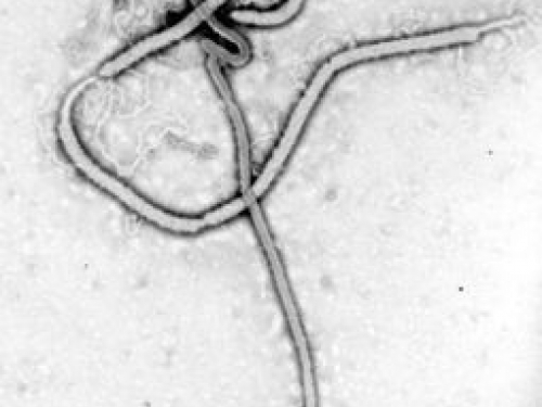 electron microscope photo of ebola virus