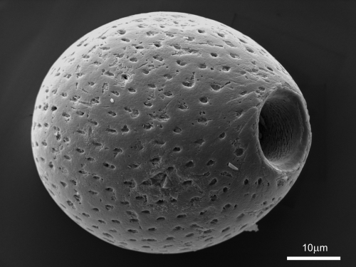 ancient algae shell microphotograph