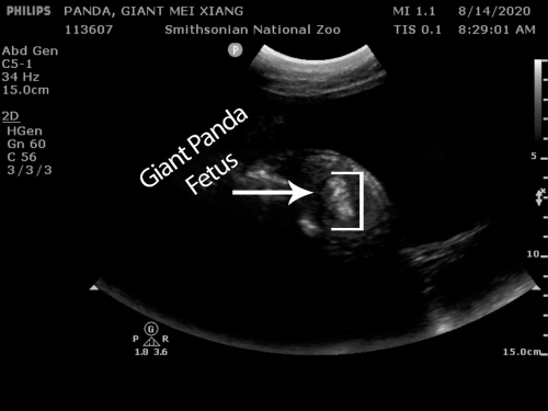 Panda ultrasound showing fetus