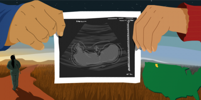 illustration of ultrasound
