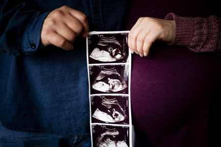 Two people holding a sonogram between them